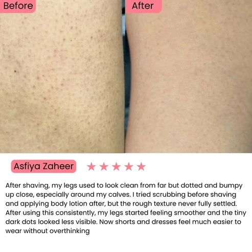 Exfoliating Kojic Acid Turmeric Spray