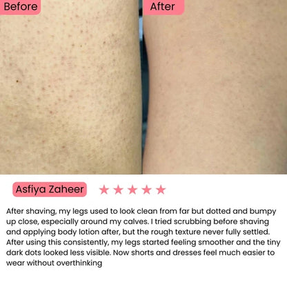 Exfoliating Kojic Acid Turmeric Spray