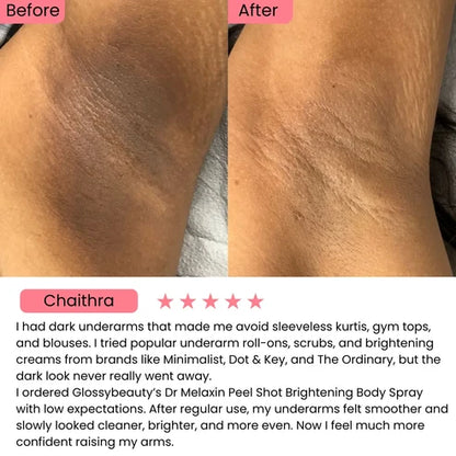 Exfoliating Kojic Acid Turmeric Spray