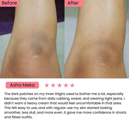 Exfoliating Kojic Acid Turmeric Spray
