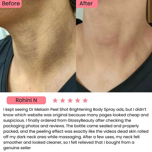 Exfoliating Kojic Acid Turmeric Spray