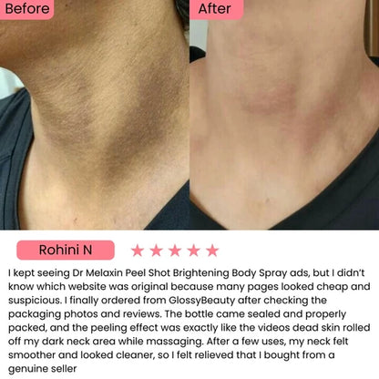 Exfoliating Kojic Acid Turmeric Spray