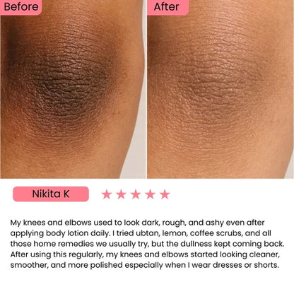 Exfoliating Kojic Acid Turmeric Spray
